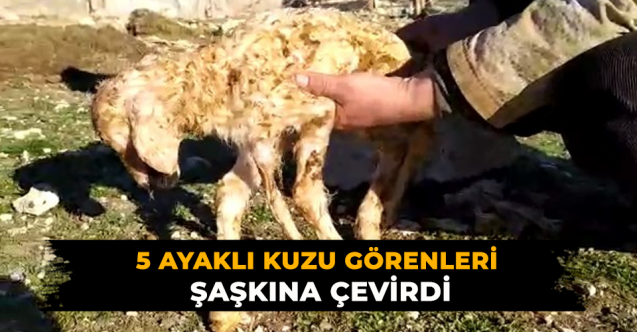 Bir ayağı fazla dünyaya geldi. Görenler şaşkınlığını gizleyemedi
