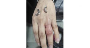 Parmağa sıkışan yüzüğü itfaiye ekipleri çıkardı