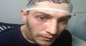 Epilepsi hastası genç, iş aramak için gittiği mahallede önce darp, ardından da gasp edildi