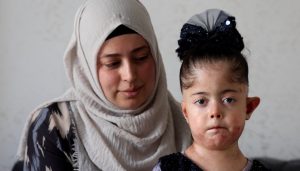 Elazığ’da yaşayan Gülsüm Aydın’ın tek dileği kelebek hastası kızına doyasıya sarılabilmek