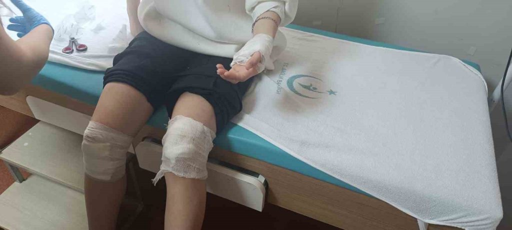 Elazığ’da sokak köpeklerinin saldırısına uğrayan 17 yaşındaki kız yaralandı